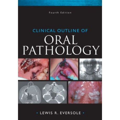 CLINICAL OUTLINE OF ORAL PATHOLOGY 4ED