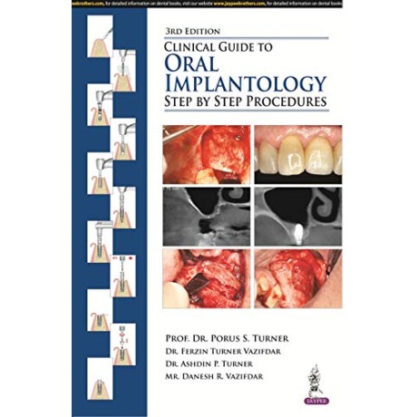 Clinical Guide to Oral Implantology: Step by Step Procedures