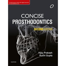 Concise Prosthodontics, 2e