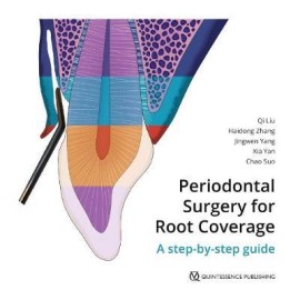 Periodontal Surgery for Root Coverage 2020