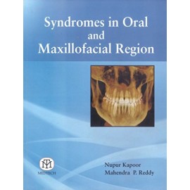 Syndromes In Oral And Maxillofacial Region