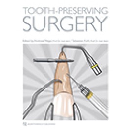  Tooth-Preserving Surgery